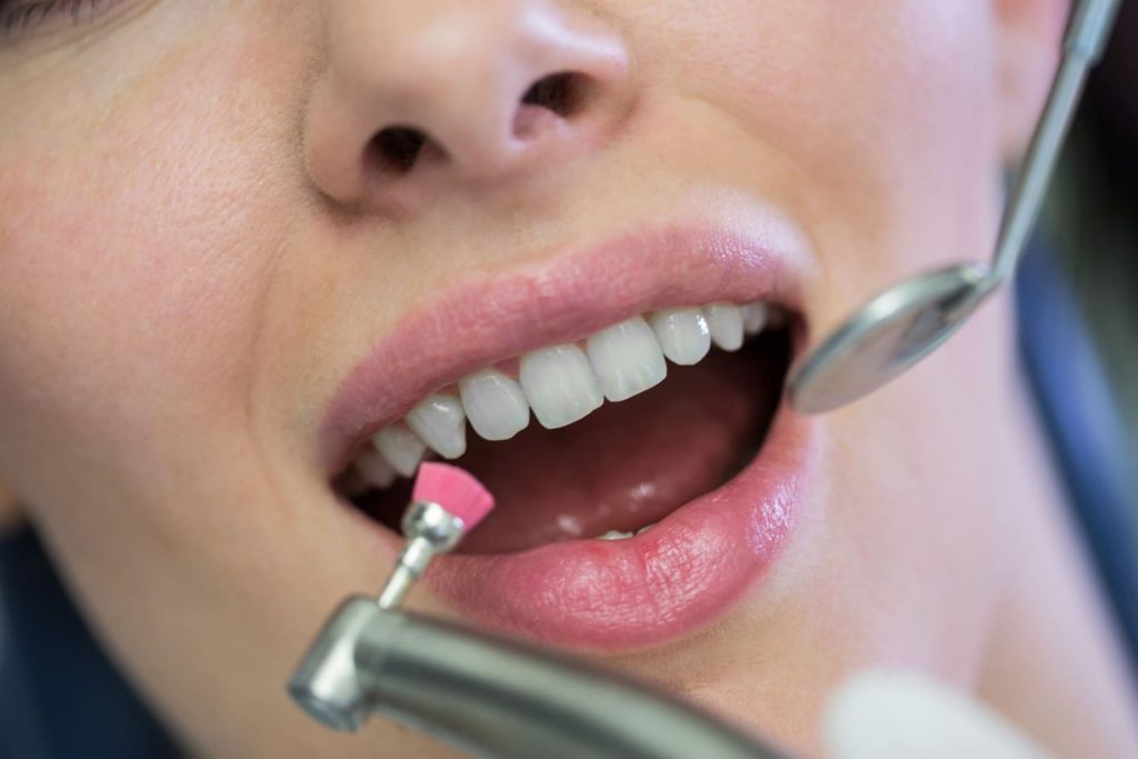 Quanto dura la pulizia dei denti 1 Quanto dura la pulizia dei denti