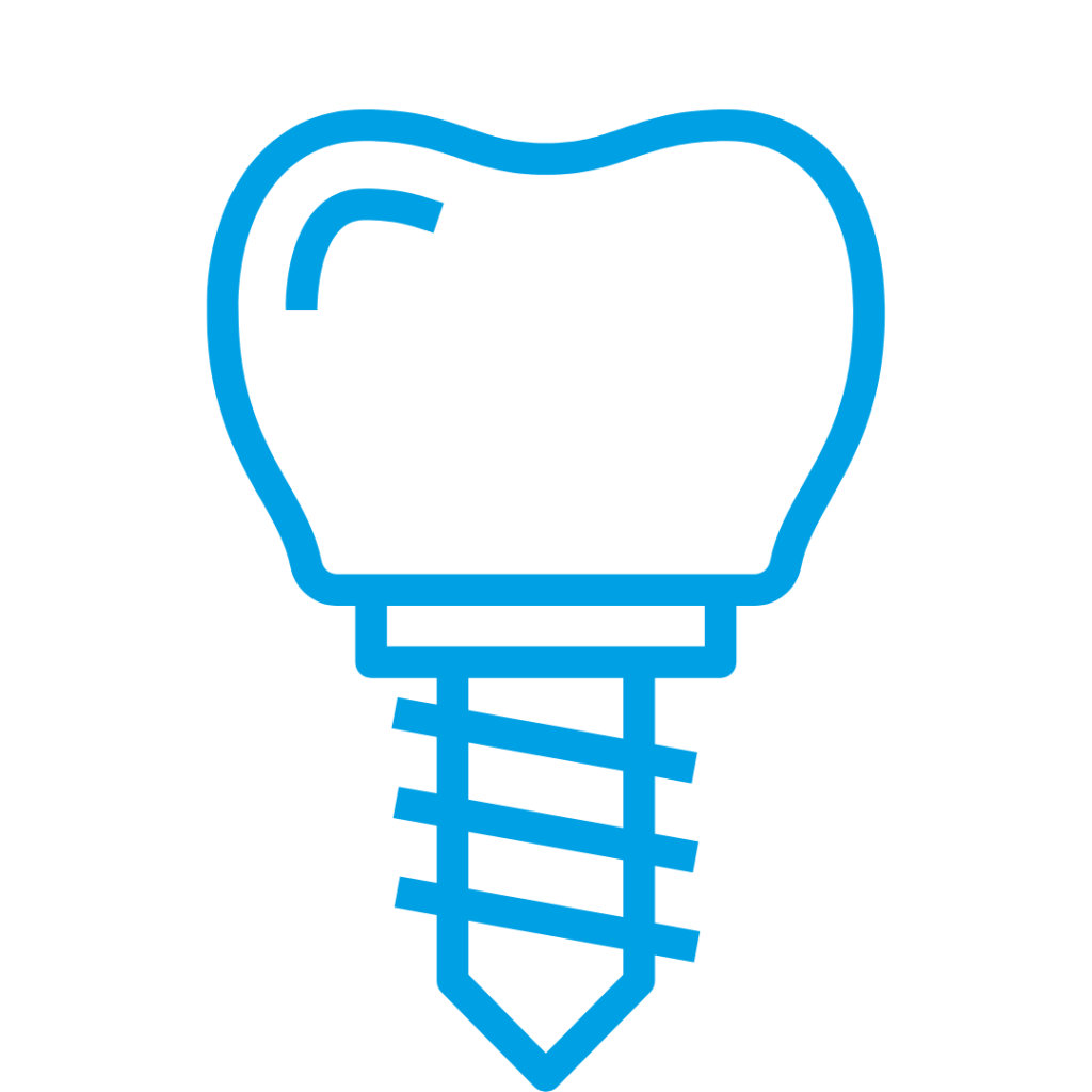 Blog 18 Implantologia