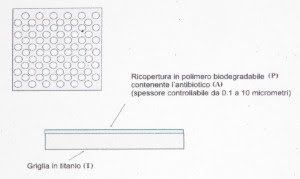 Griglia di titanio con rilascio di antibiotico 1 Griglia di titanio con rilascio di antibiotico